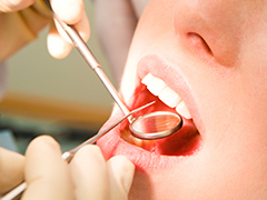 歯科医院での定期検診